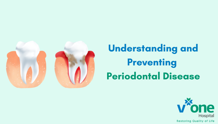 Understanding and Preventing Periodontal Disease by Best Dentist in Indore