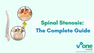 Spinal Stenosis guide by orthopaedic doctor in indore