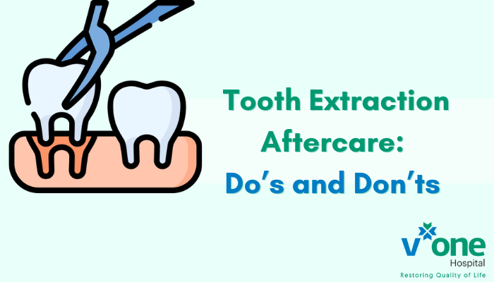 Tooth Extraction Aftercare Tips from Best Dentist in Indore